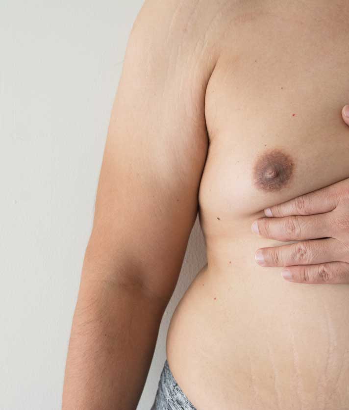 M&auml;nnlicher Oberk&ouml;rper, eine Hand st&uuml;tzt die h&auml;ngende Brust.