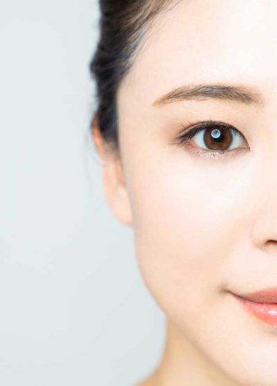 Augenpartie einer jungen, asiatischen Frau nach einer Augenlid-OP.
